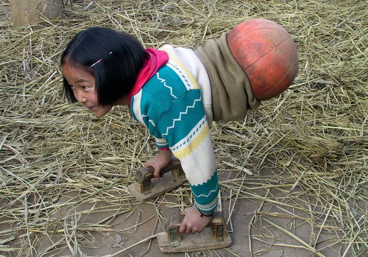 Дівчинка з баскетбольним м'ячем замість ніг стала відомою спортсменкою1