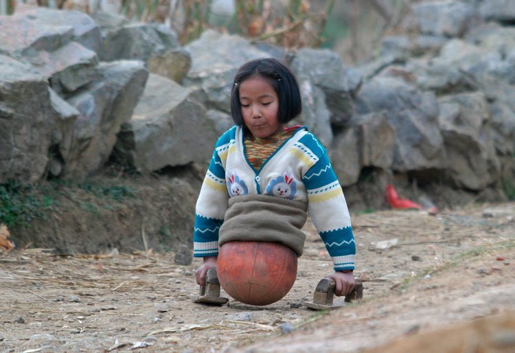 Дівчинка з баскетбольним м'ячем замість ніг стала відомою спортсменкою2